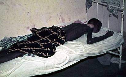 Maladie sommeil