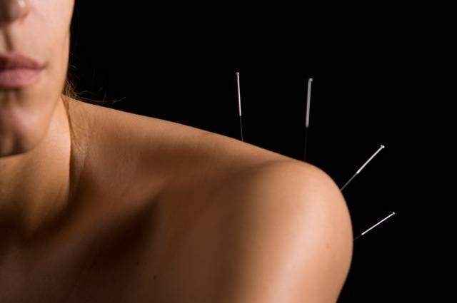 acupuncture angoisse