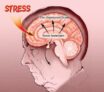 Hormones du stress